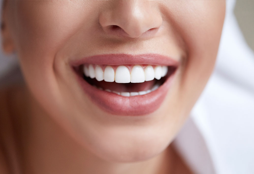 Teeth Whitening - PHR Laser Centers - teeth(1)