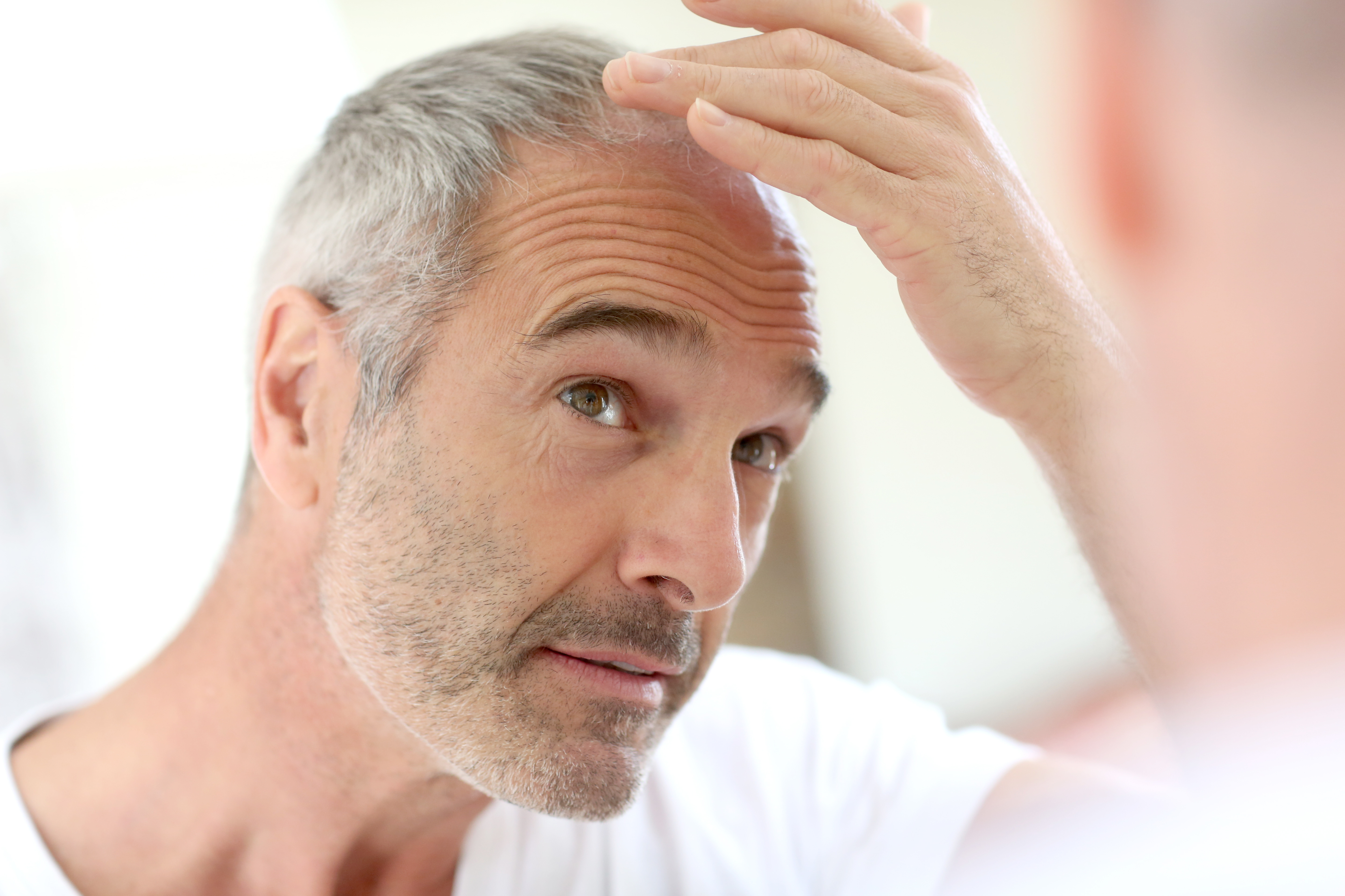 Hair Restoration Services in Plymouth, MI | PCR Centers - hair-loss