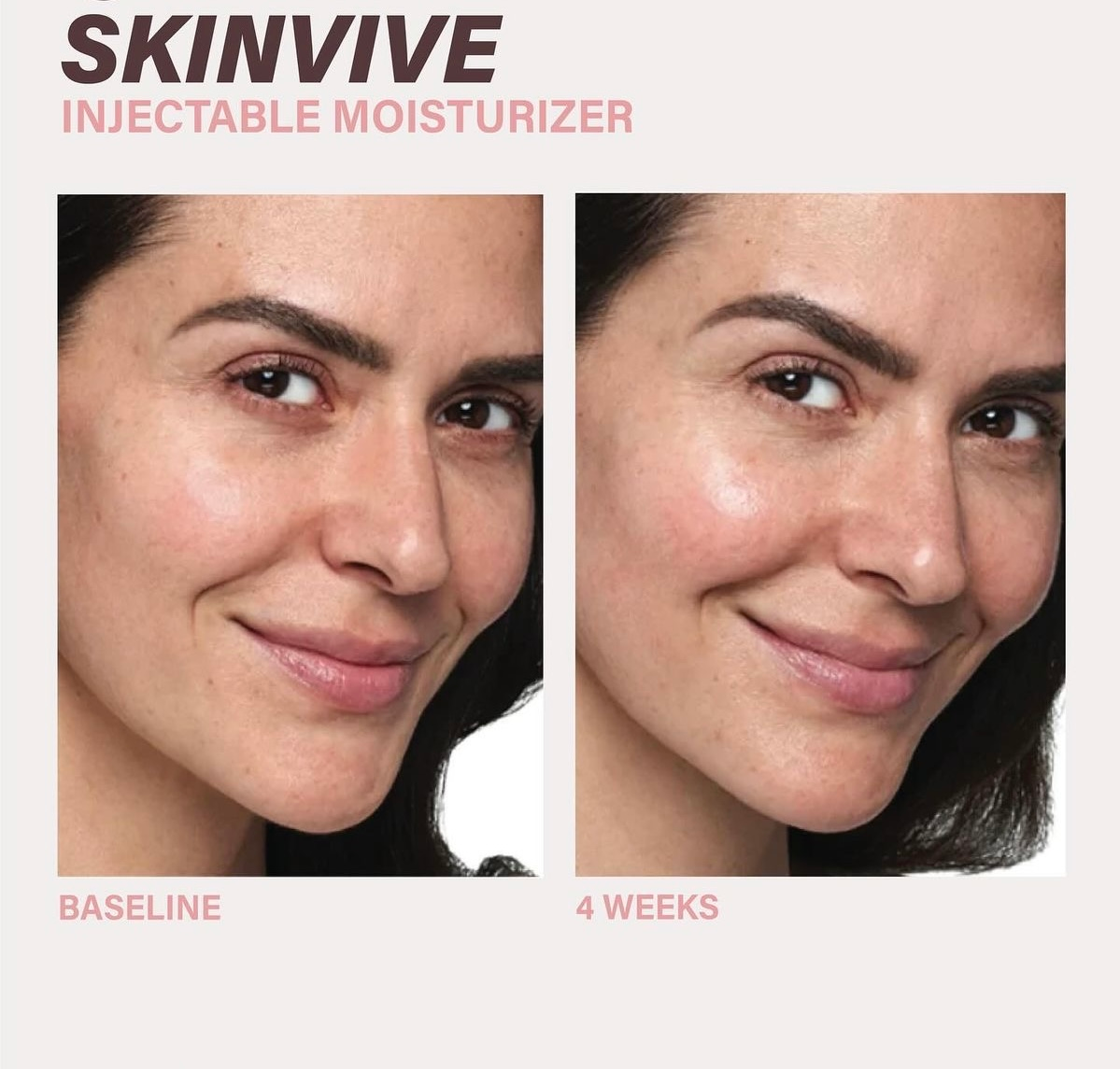 Injectables - PHR Laser Centers - image%20%2875%29%20%282%29