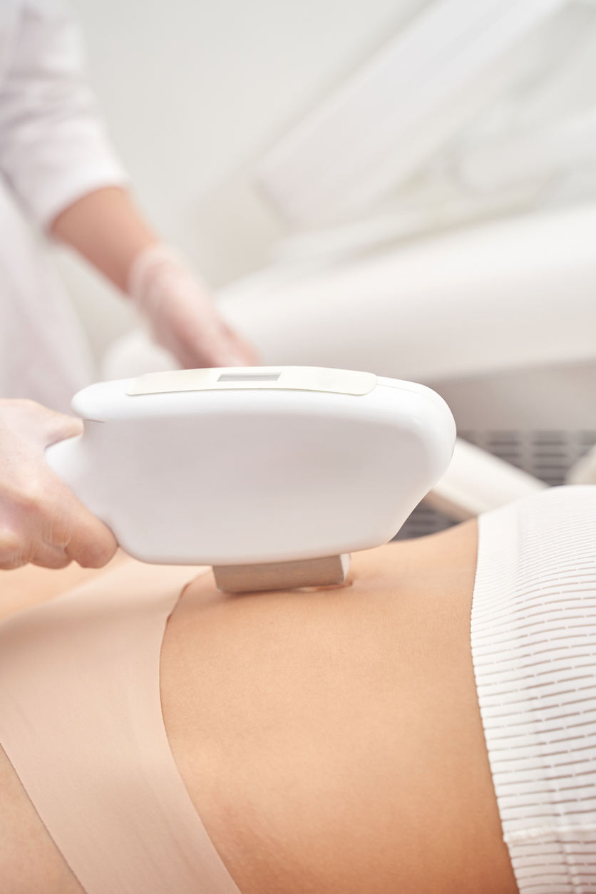 Laser Hair Removal at PHR Laser Centers near Ann Arbor