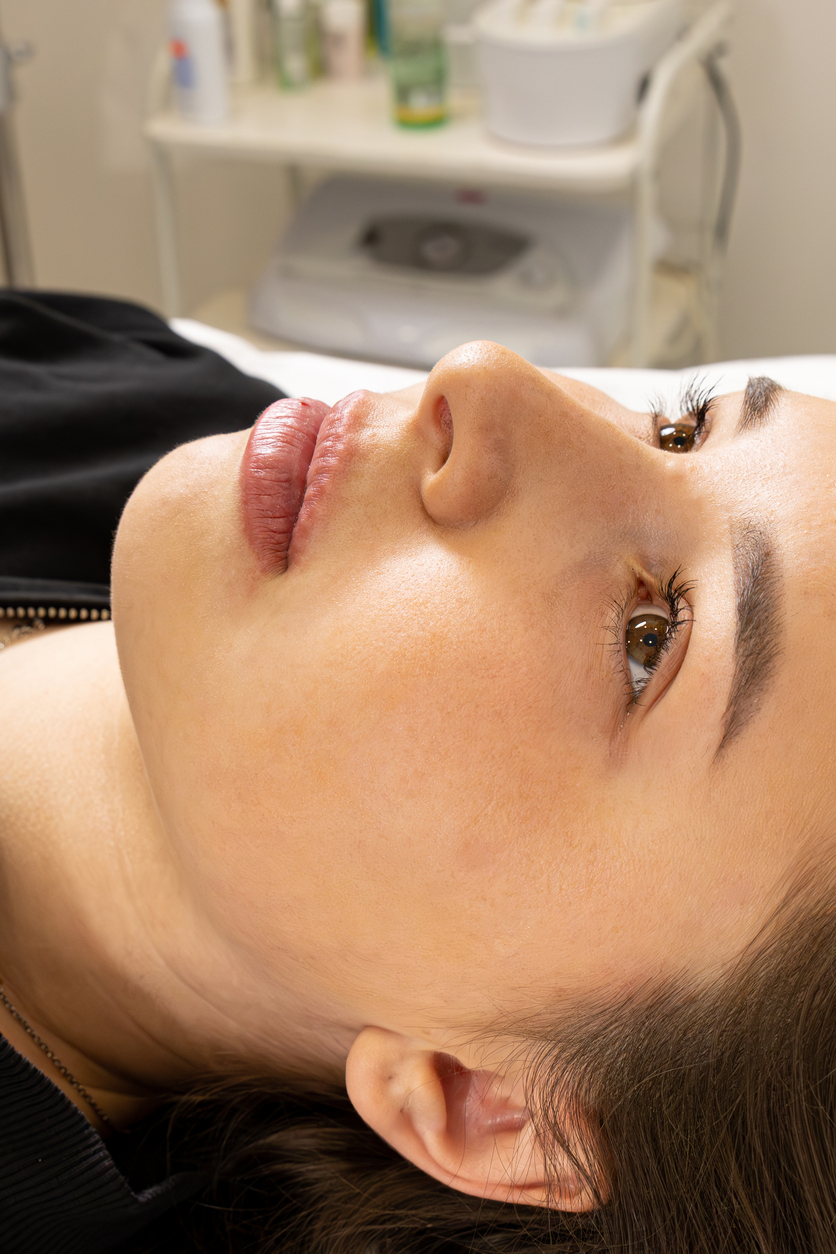 Hyaluronic Acid Lip Fillers at PHR Centers
