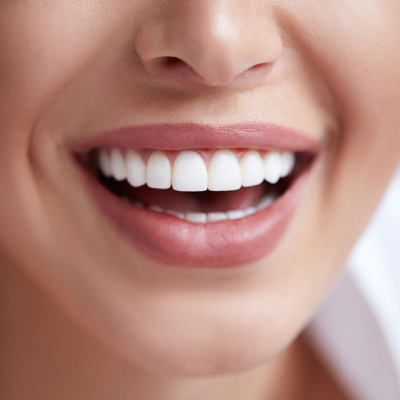 teeth whitening service in plymouth mi