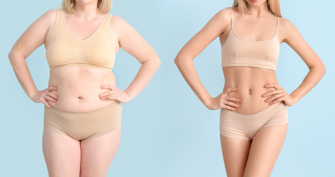 Laser Hair Removal at PHR Center